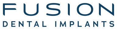 Fusion Dental Implants