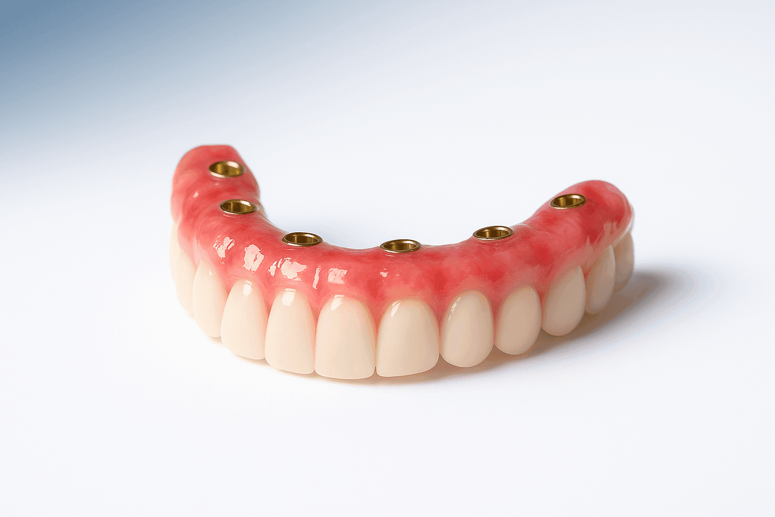 Full-Arch Dental Implants