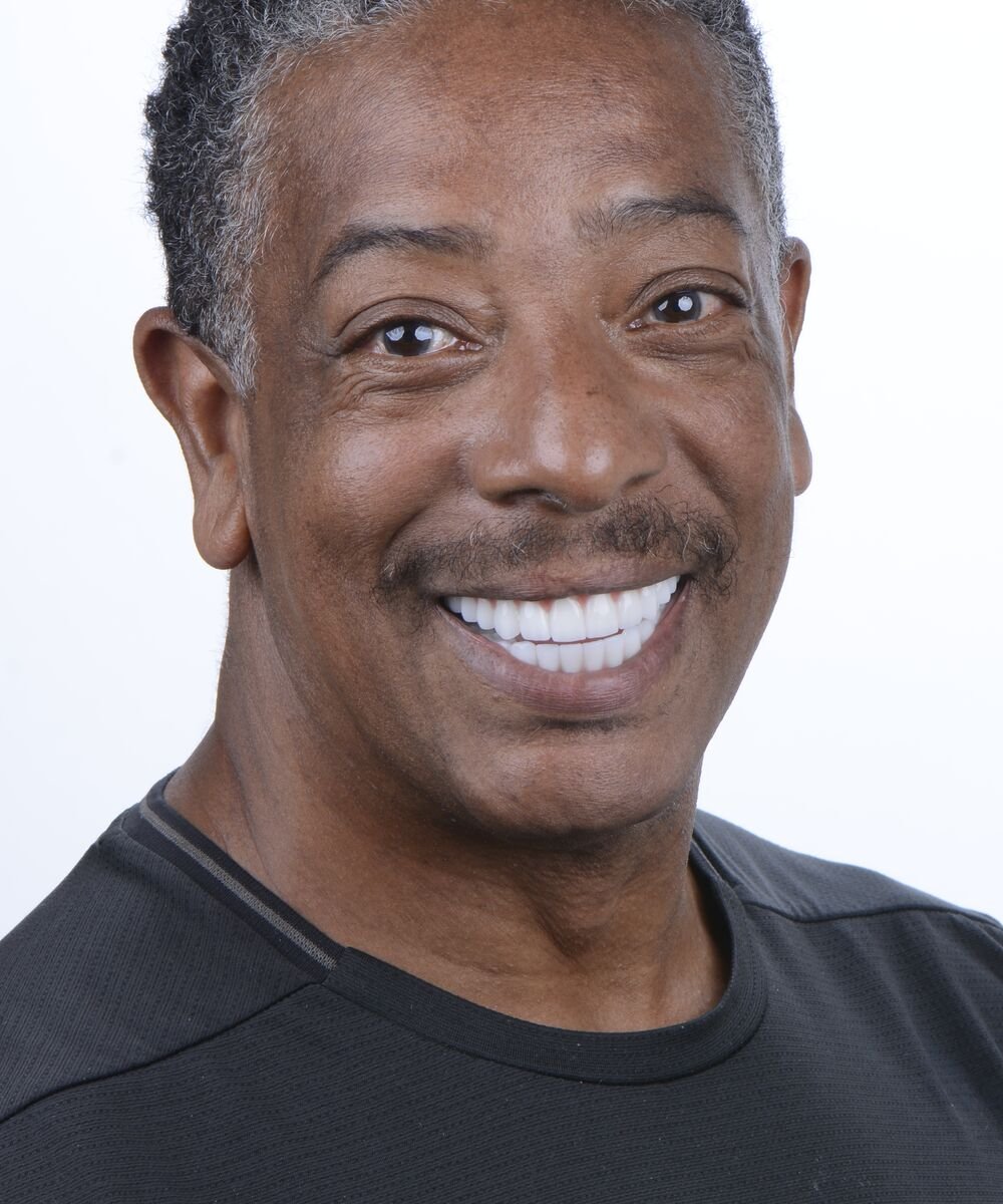 After - Dental implant transformation - full smile restoration