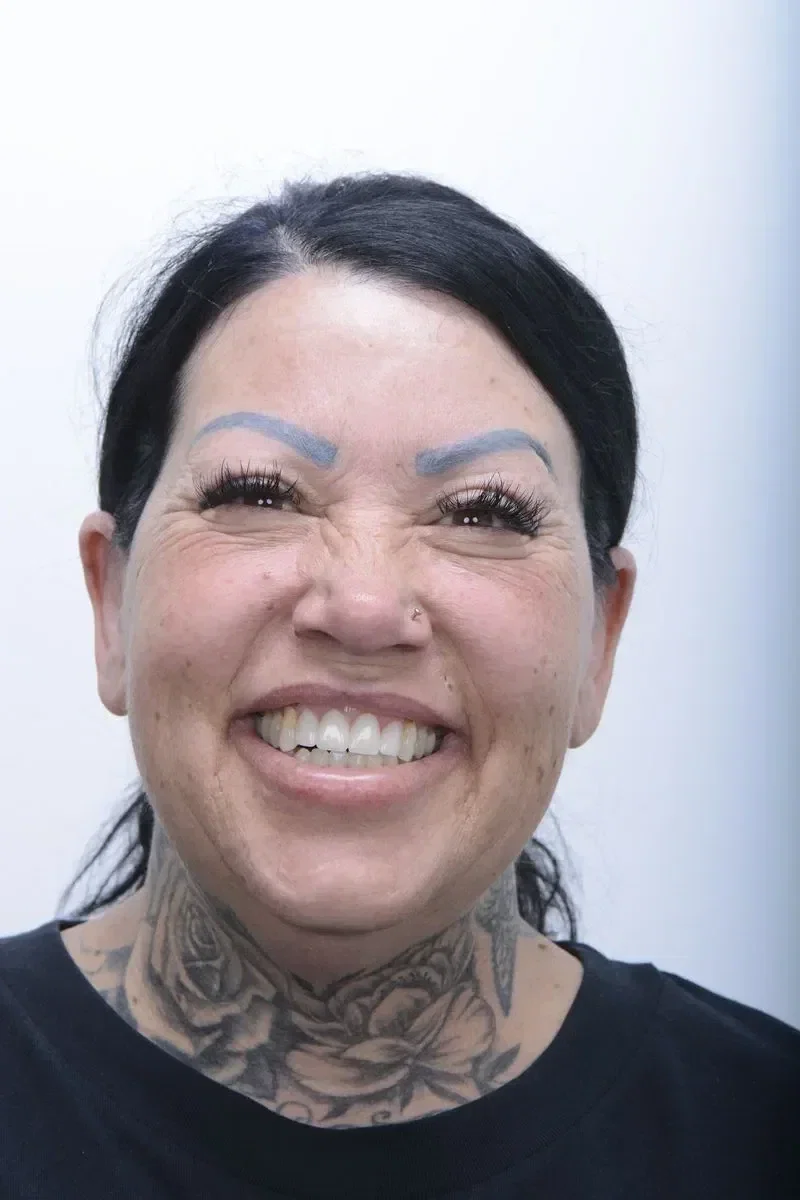 After - Dental implant transformation - confident new smile